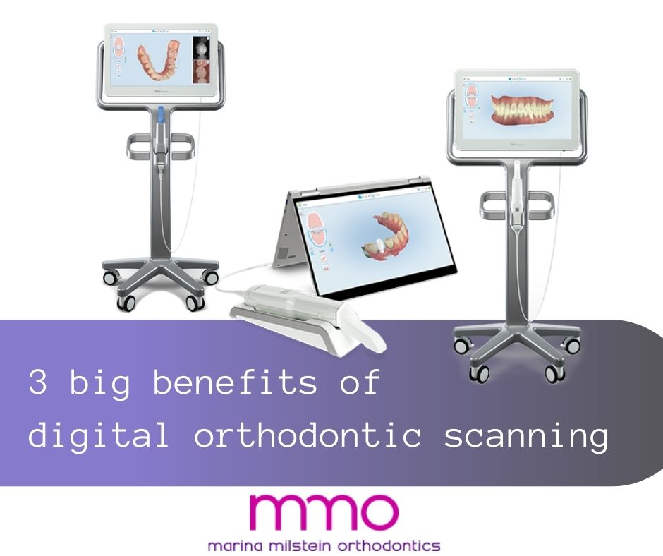 Digital Orthodontic Scanning