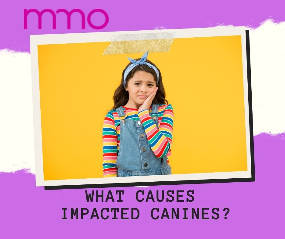 Impacted Canines