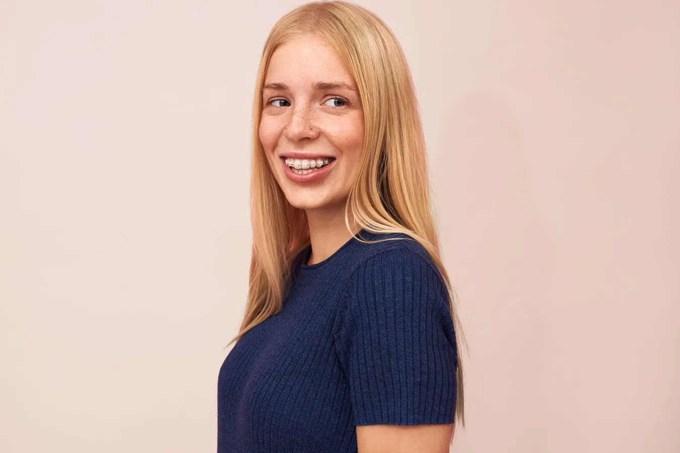 Adult patient with traditional braces Adult orthodontic patient wearing traditional metal braces during treatment